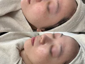 Osaka Umeda Korean Facial Lifting and Skin Care Salon IROHA 4