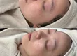 오사카 우메다 한국식 소안(小顔) 리프팅 & 피부 관리 살롱 IROHA 4