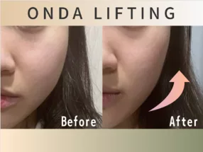 Osaka Umeda Korean Facial Lifting and Skin Care Salon IROHA 1