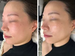 Osaka Umeda Korean Facial Lifting and Skin Care Salon IROHA 5